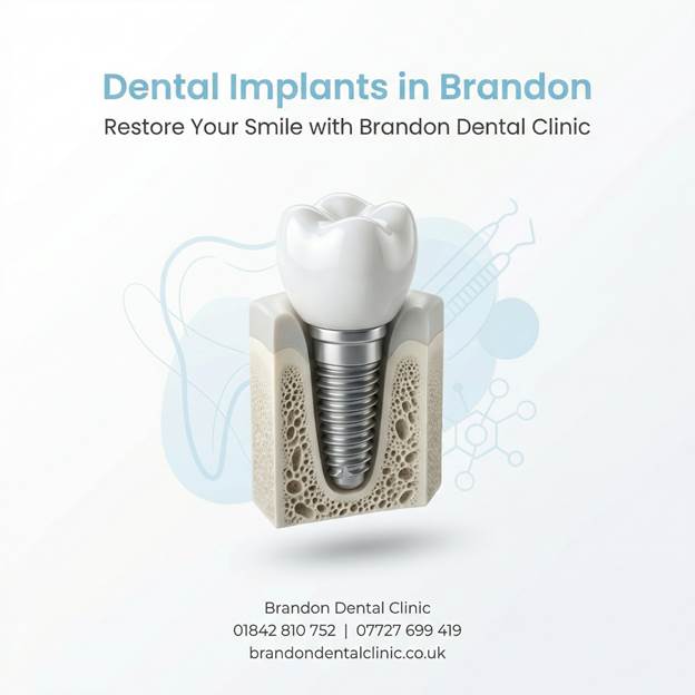 Dental Implants in Brandon – Restore Your Smile at Brandon Dental Clinic