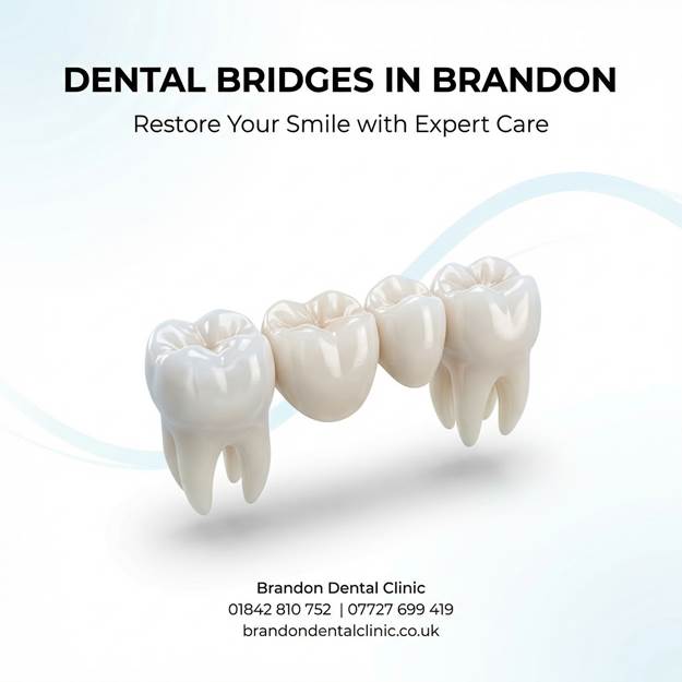 Dental Bridges in Brandon – Restore Your Smile with Expert Care at Brandon Dental Clinic
